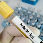 تاثیر پرولاکتین بالا بر باروری: علل، علائم و راهکارهای درمانی مؤثر